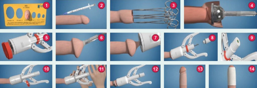 Andrology Treatment in Delhi and Bahadurgarh 9