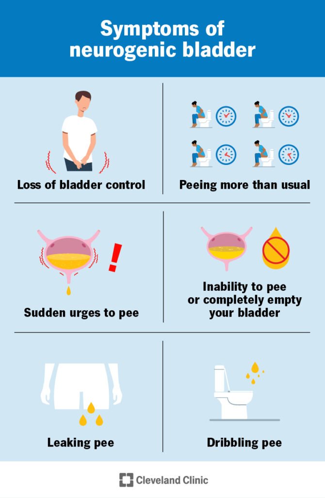 Neurogenic Bladder Treatment in Delhi & Bahadurgarh neurogenic bladder
