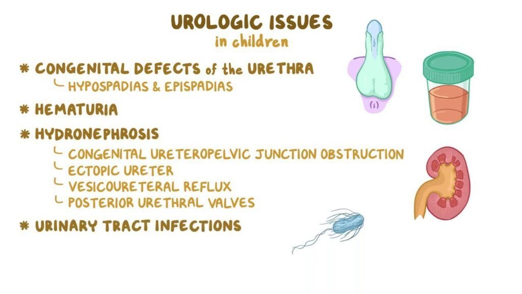 Paediatric urology Treatment in Delhi and Bahadurgarh